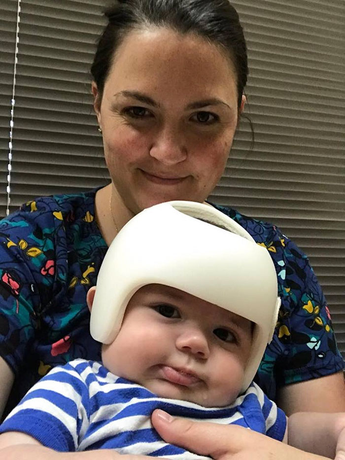 O bebê de quatro meses Jonas Gutierrez, de San Antonio, Texas (EUA), foi forçado a usar um capacete após ser diagnosticado com Plagiocefalia. Para que ele não se sentisse diferente de todos os outros, toda a família decidiu usar capacetes também