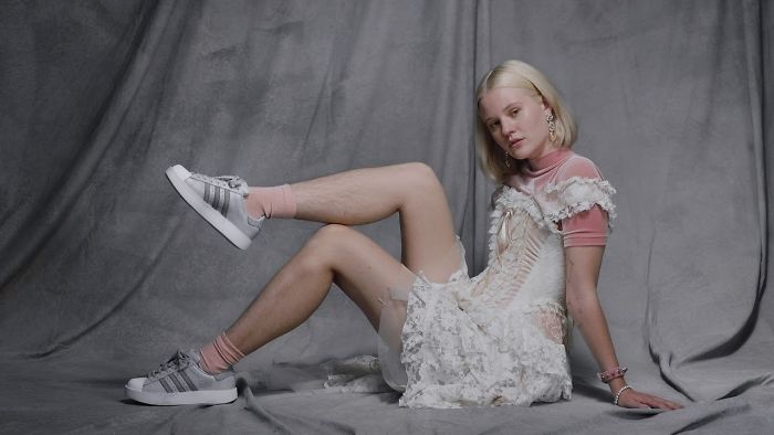 Modelo sueca recebeu ameaças por Instagram por não depilar as pernas