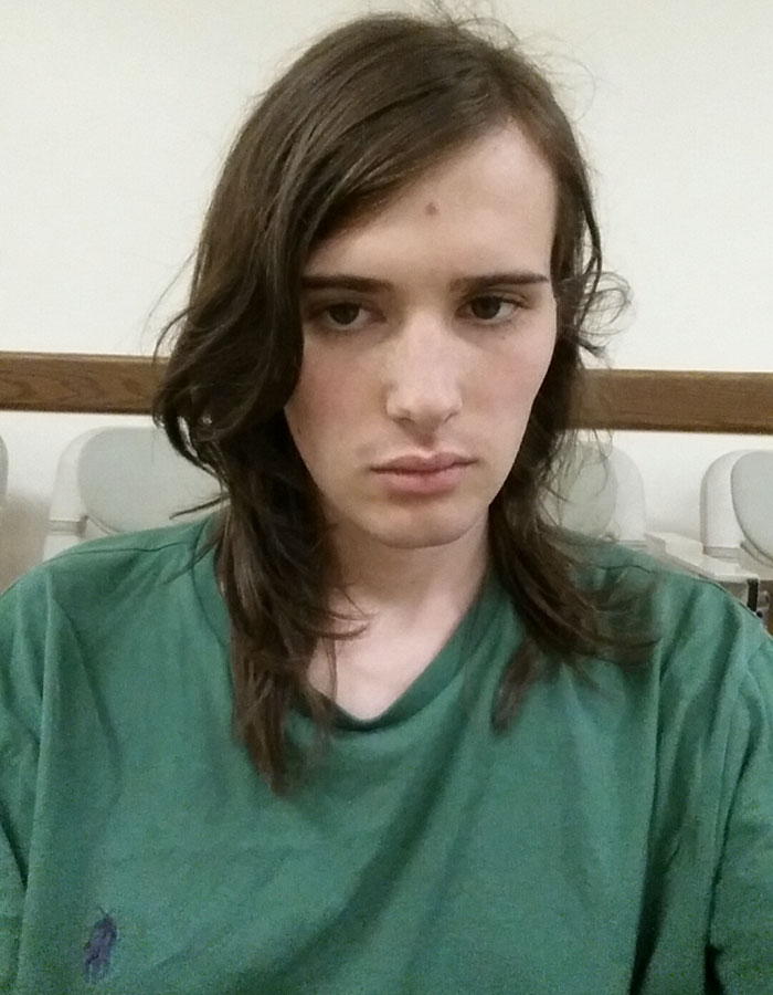 12 meses de terapia hormonal