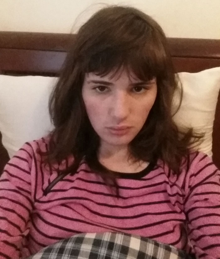 15 meses de terapia hormonal