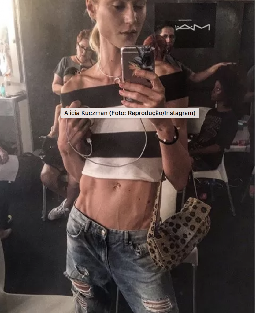 A magreza da modelo nas semanas de moda do Brasil e nas redes sociais foi alvo de críticas em 2010. Em 2016, Alicia Kuczman postou foto em que aparece com barriga chapada