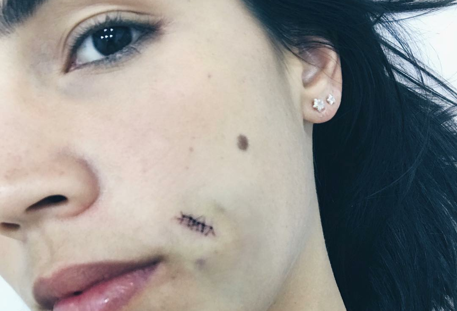 Atriz Pérola Faria sofre pequeno acidente ao surfar