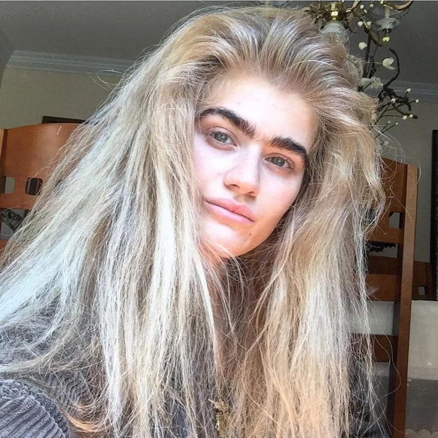 Modelo Sophia Hadjipanteli ostenta monocelha e incentiva autoestima