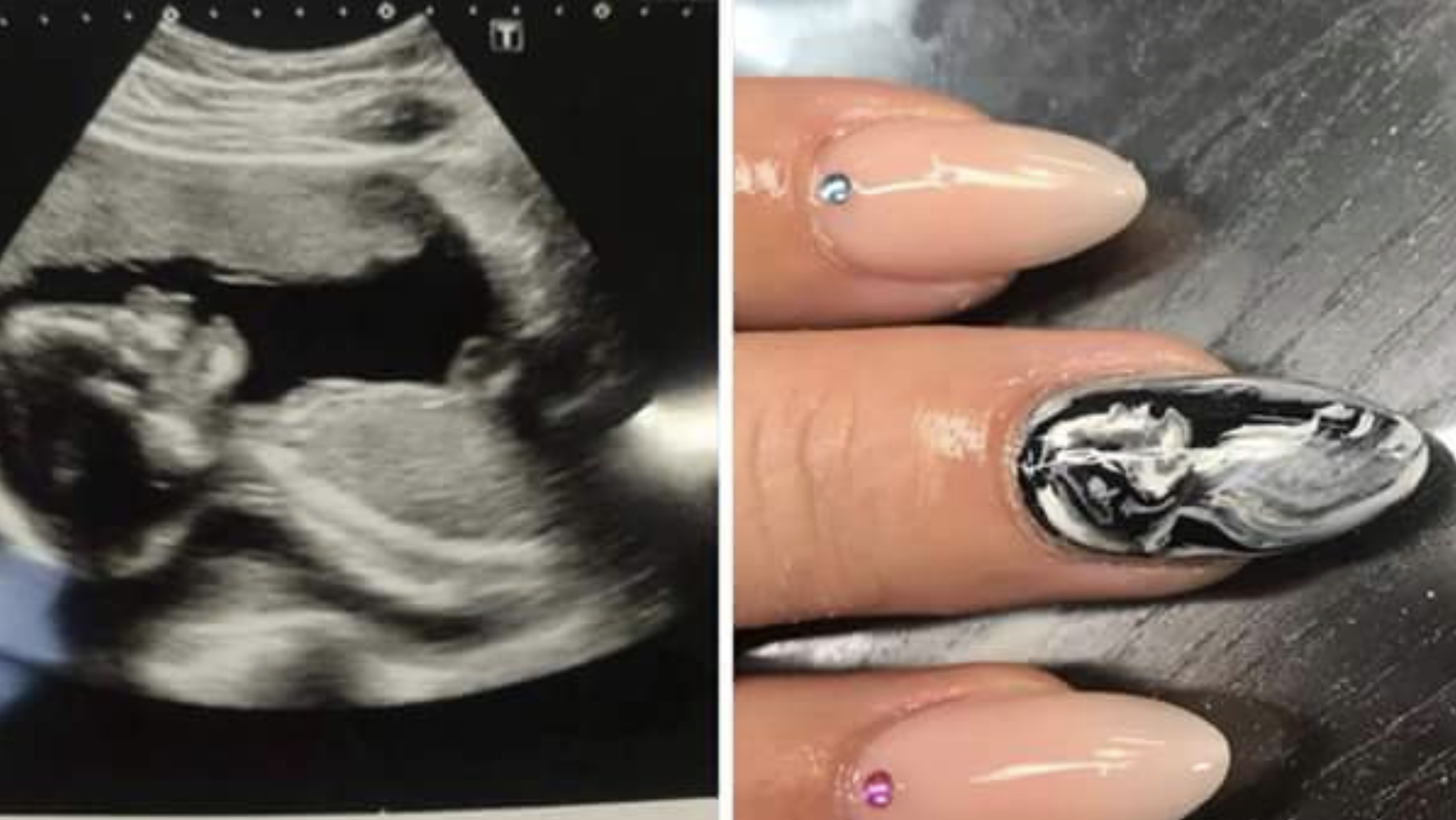 Agora você pode pintar imagens do ultrassom do bebê nas unhas