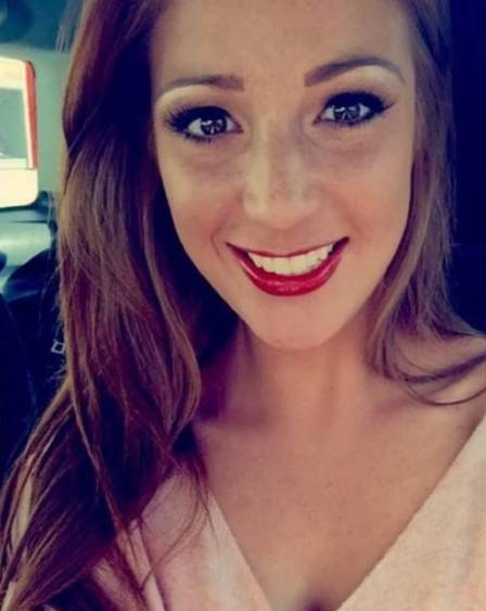 Vítima de ataque a ácido é finalista de concurso de beleza