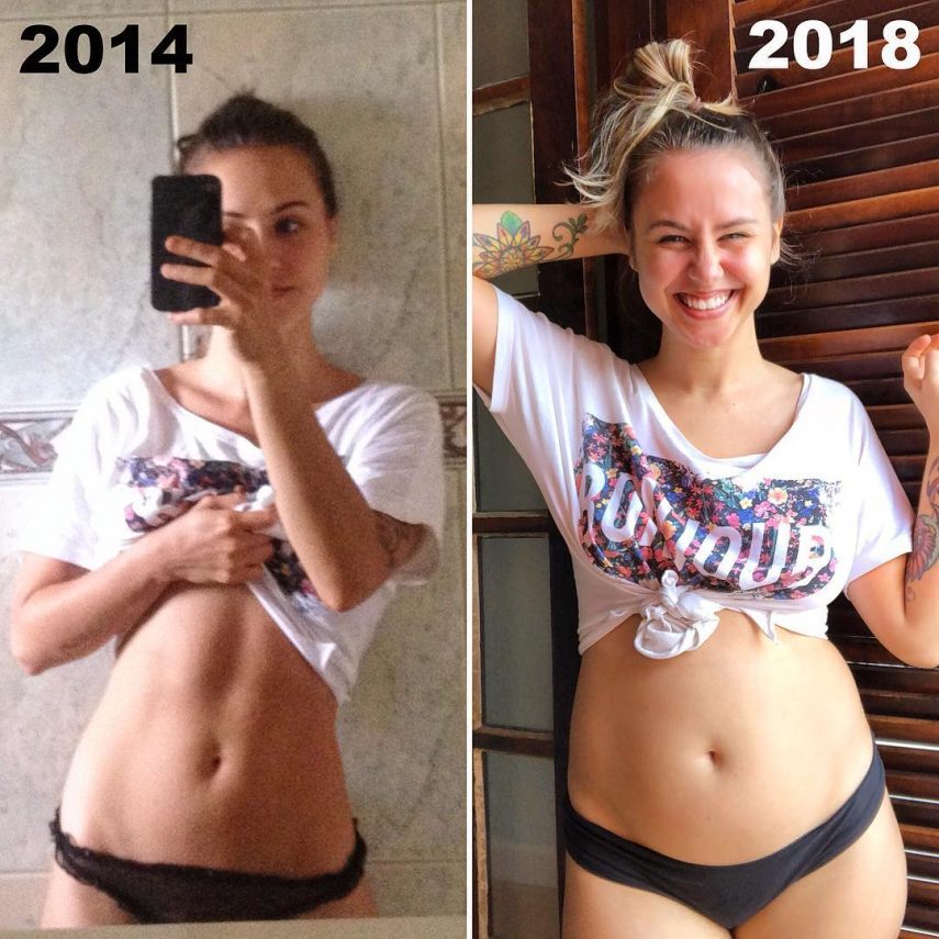Brasileira combate bulimia no Instagram