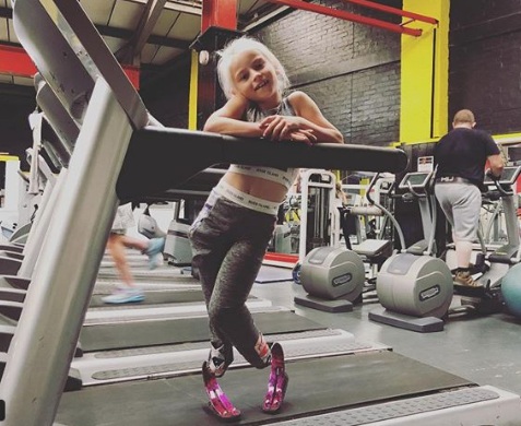 Aos 7 anos, inglesa teve pernas amputadas ainda bebê. Hoje, ela é modelo e faz sucesso nas redes sociais