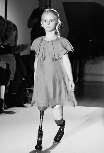 Aos 7 anos, inglesa teve pernas amputadas ainda bebê. Hoje, ela é modelo e faz sucesso nas redes sociais