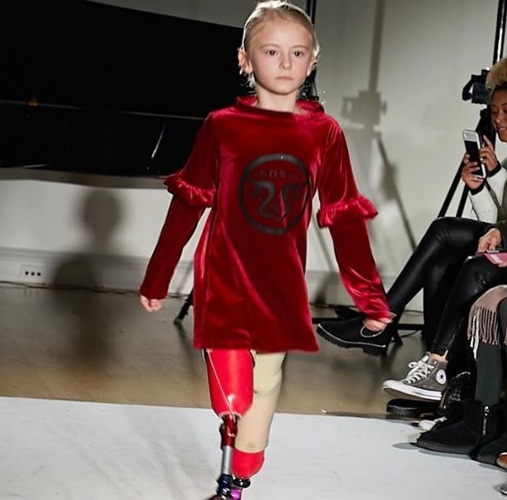 Aos 7 anos, inglesa teve pernas amputadas ainda bebê. Hoje, ela é modelo e faz sucesso nas redes sociais