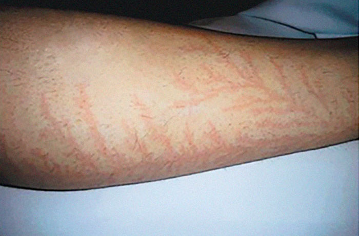 Sobreviventes mostram o que raios fazem com a pele
