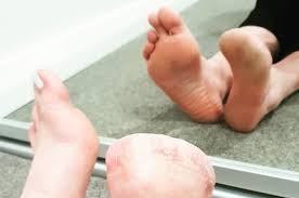 Mulher perde dedos do pé após pedicure com peixes