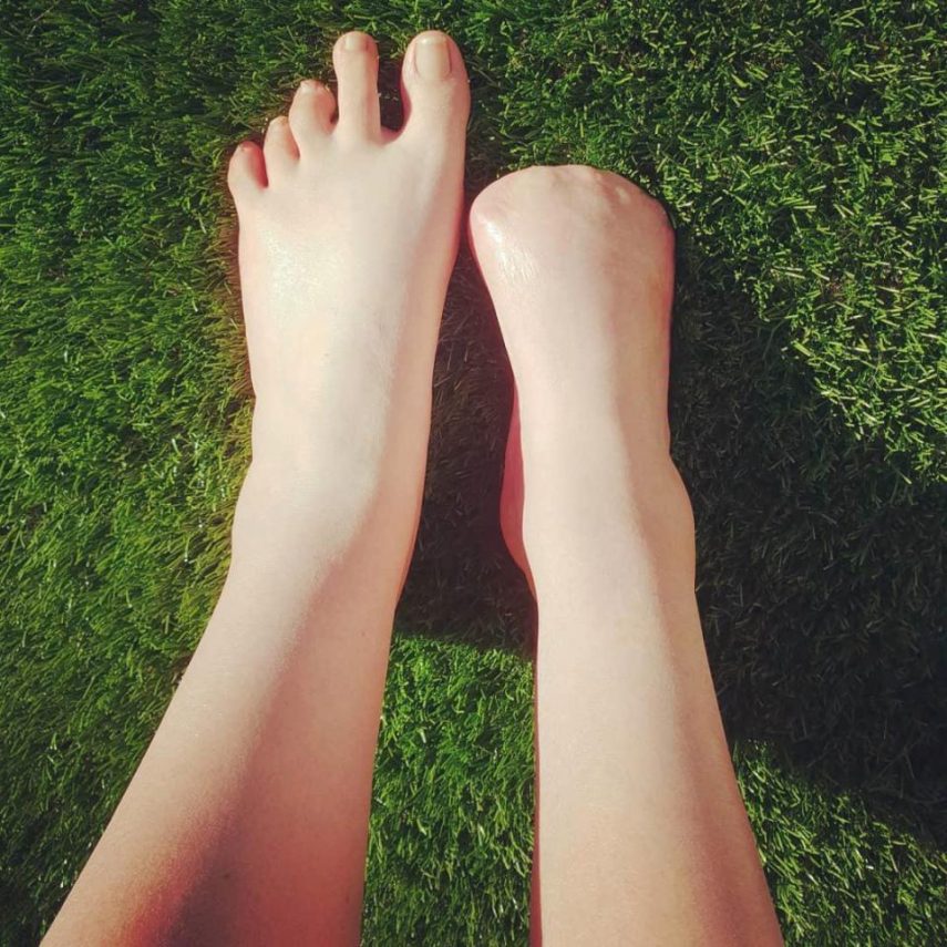 Mulher perde dedos do pé após pedicure com peixes