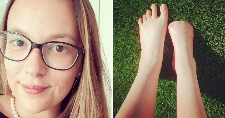 Mulher perde dedos do pé após pedicure com peixes