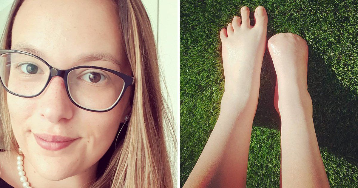 Mulher perde dedos do pé após pedicure com peixes