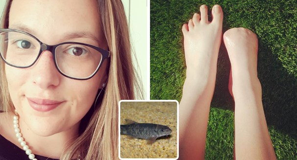 Mulher perde dedos do pé após pedicure com peixes
