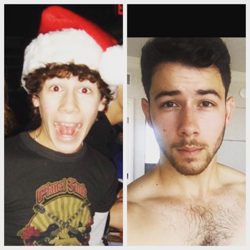 Nick Jonas