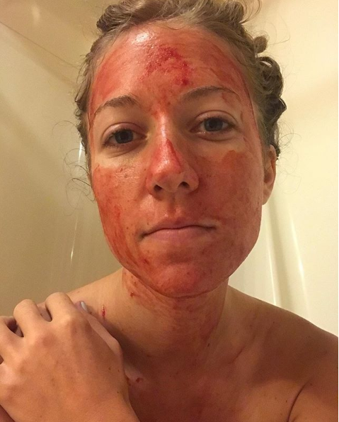 Mulher pinta o rosto com sangue menstrual todo mês; veja o motivo