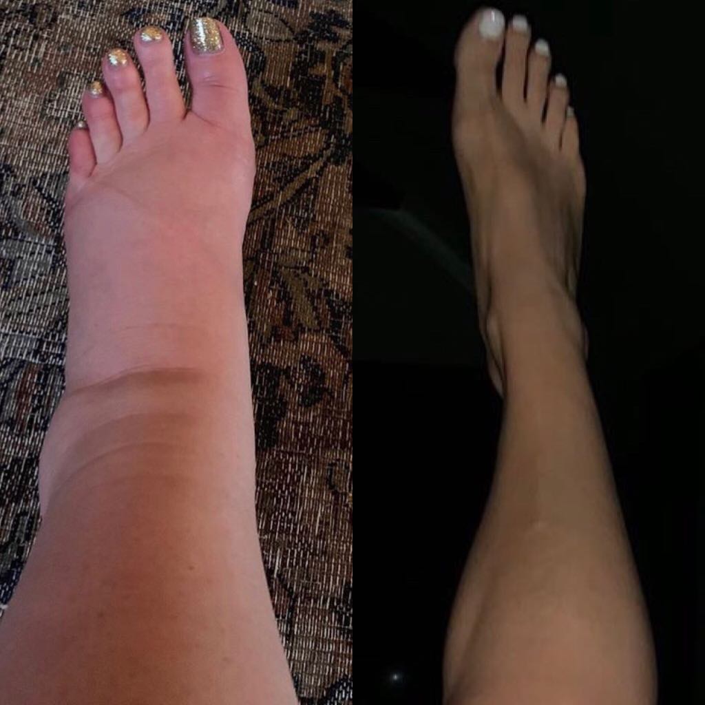 Pós-parto: Jessica Simpson impressiona com antes e depois do tornozelo –  Vírgula