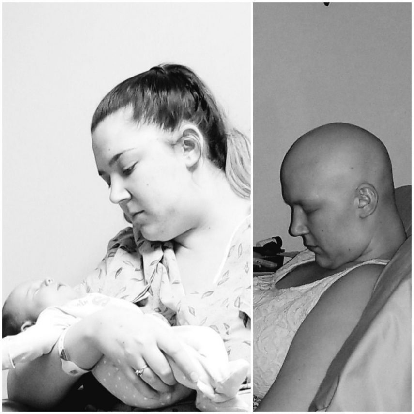 Antes e depois da quimioterapia