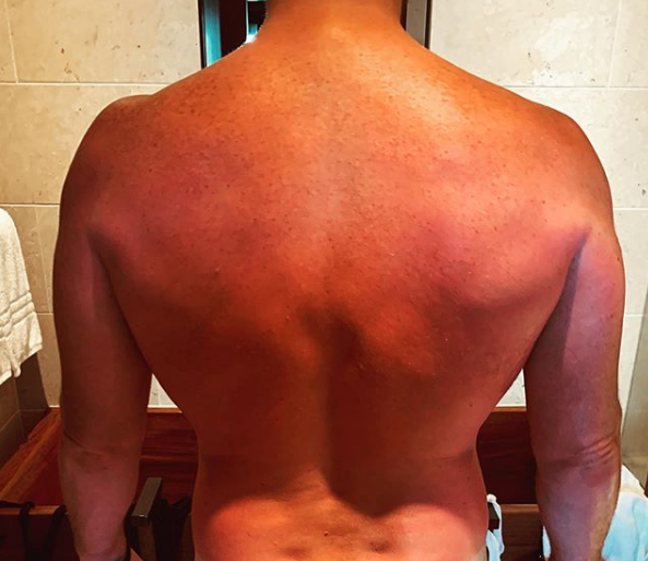 Nu, Chris Pratt choca fãs ao exibir bronzeado: 'passei do ponto'