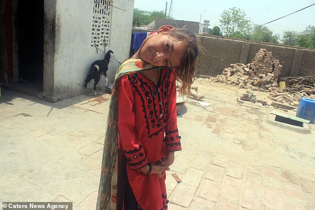 Afsheen Kumbar tem 11 anos, e está com o pescoço preso num ângulo de noventa graus desde os oito meses de idade. 