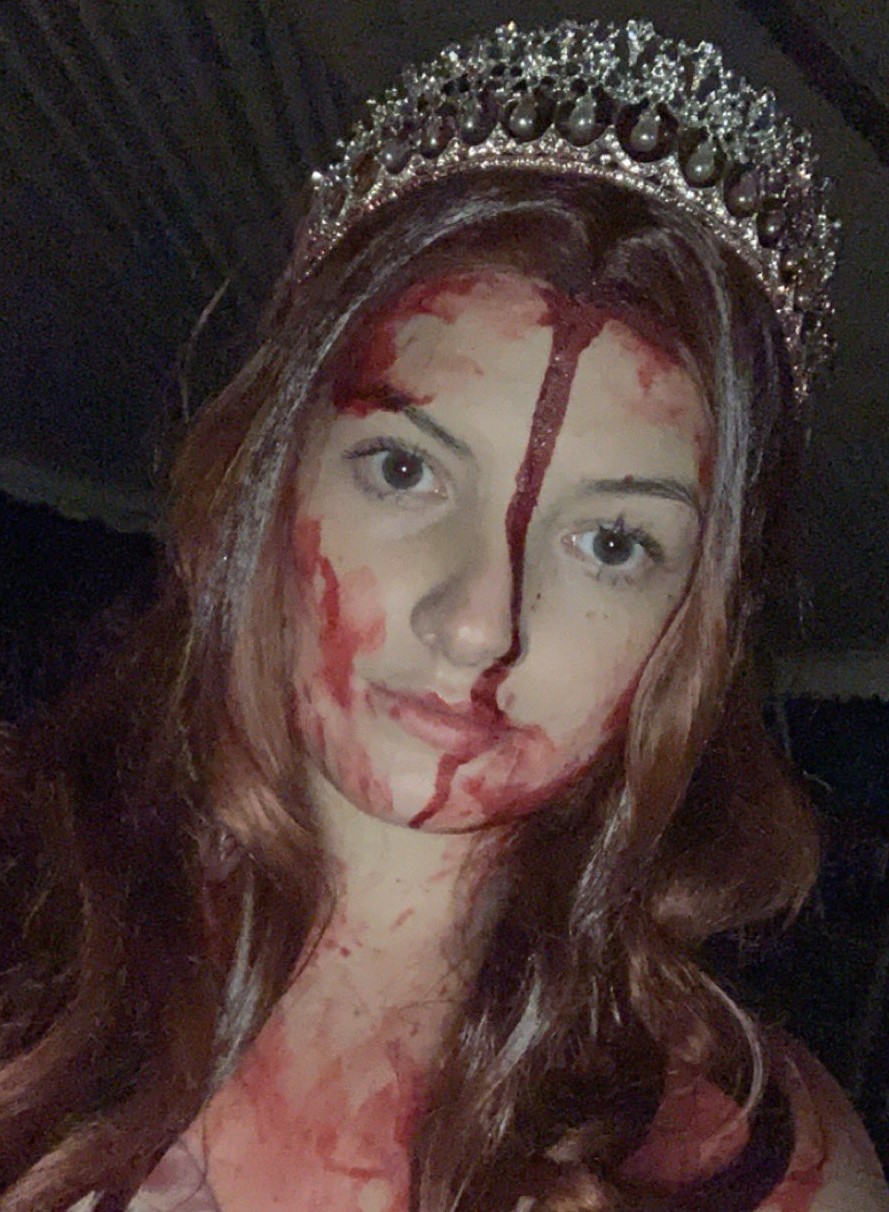 Estudante fantasiada sofre acidente e sangue falso alarma paramédicos
