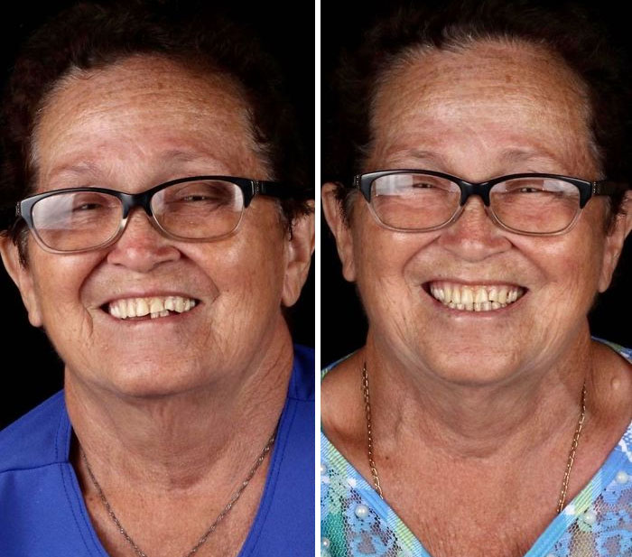 Dentista brasileiro viaja o mundo dando de volta o sorriso das pessoas