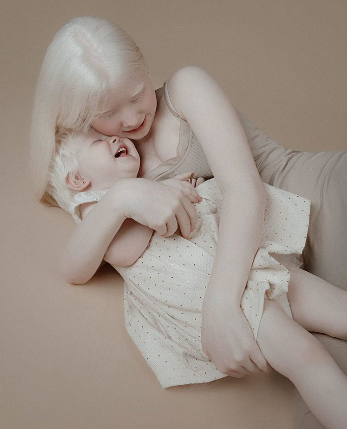Nascidas no Cazaquistão, irmãs albinas fazem sucesso como modelos