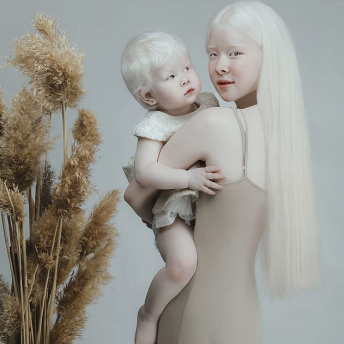 Nascidas no Cazaquistão, irmãs albinas fazem sucesso como modelos