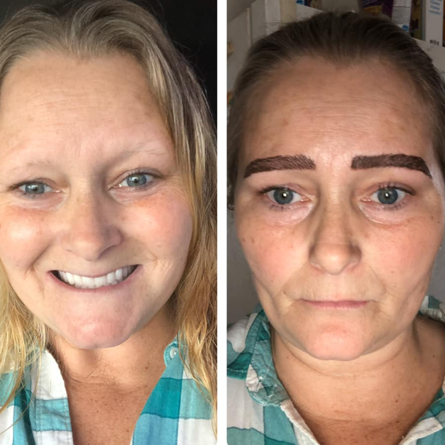 Mulher se revolta com resultado de micropigmentação nas sobrancelhas
