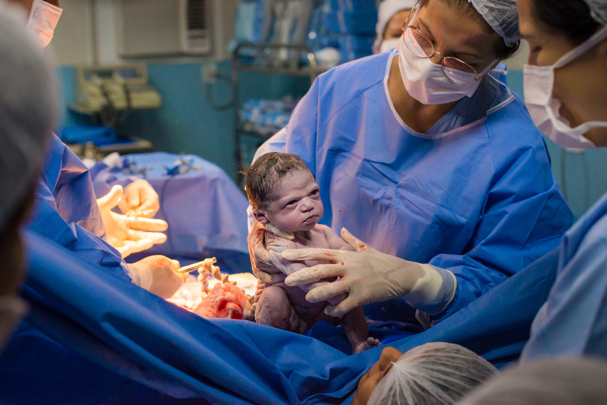 Bebê faz "cara de bravinha" para médica ao nascer e foto viraliza