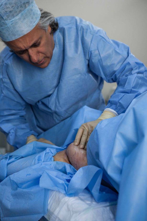 Mulher com 4 seios passa por cirurgia para remoção de volume extra
