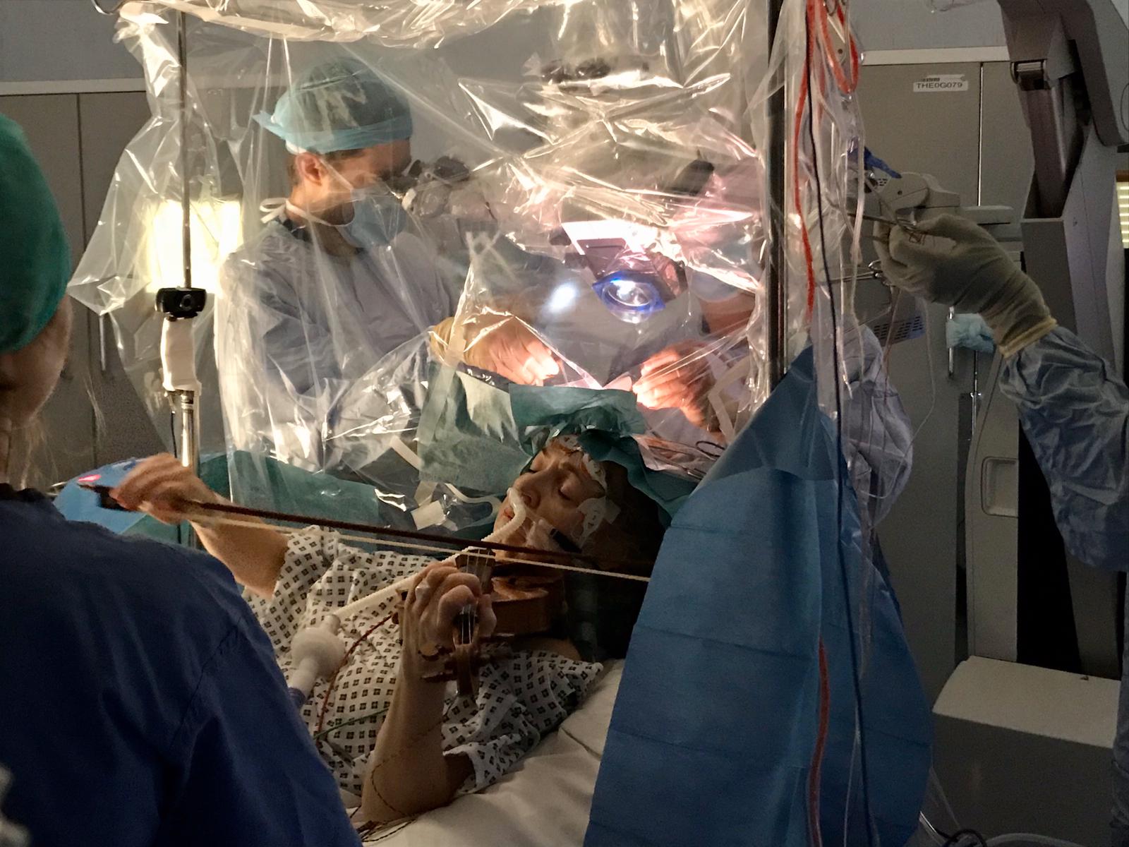Paciente toca violino durante cirurgia para remoção de tumor cerebral