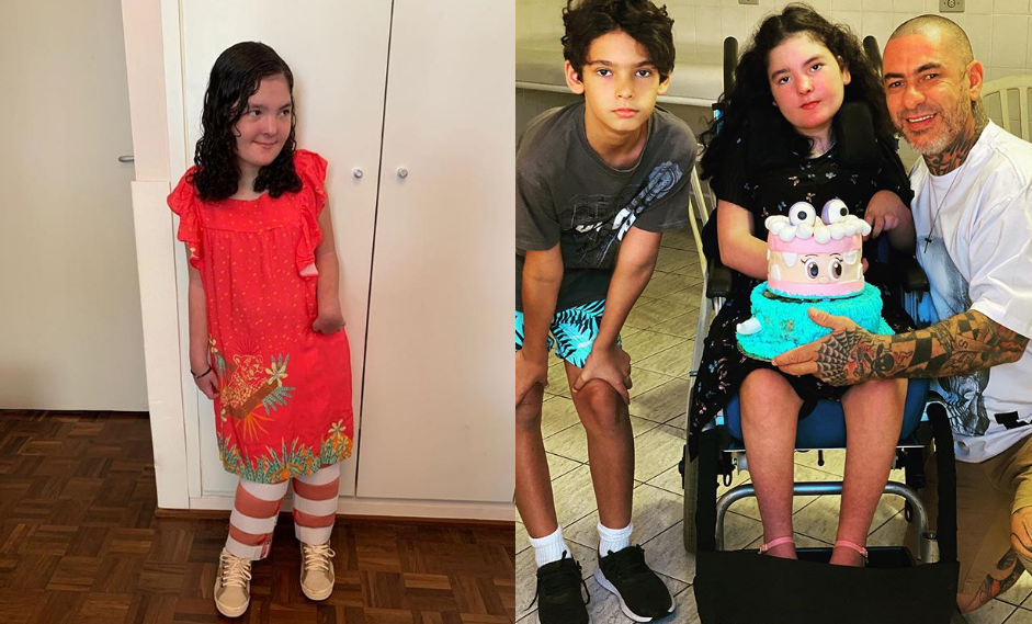 Fogaça se orgulha de evolução da filha com doença rara: "15 minutos em pé"