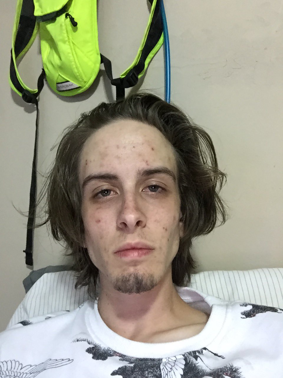 Homem mostra antes e depois de largar as drogas e a transformação é incrível
