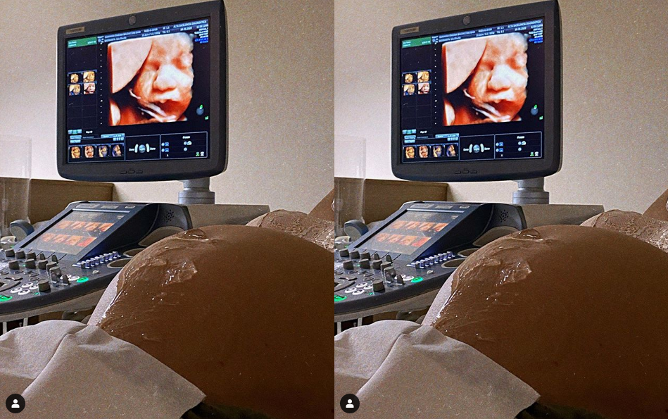 Giovanna Ewbank mostra rostinho do filho no ultrassom: "Ansiosos"