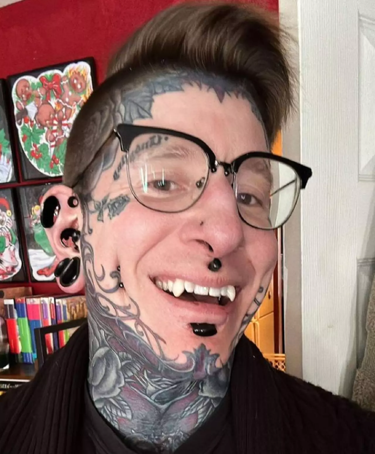 Canadense muda visual e agora tem “dentes de vampiro”; veja resultado