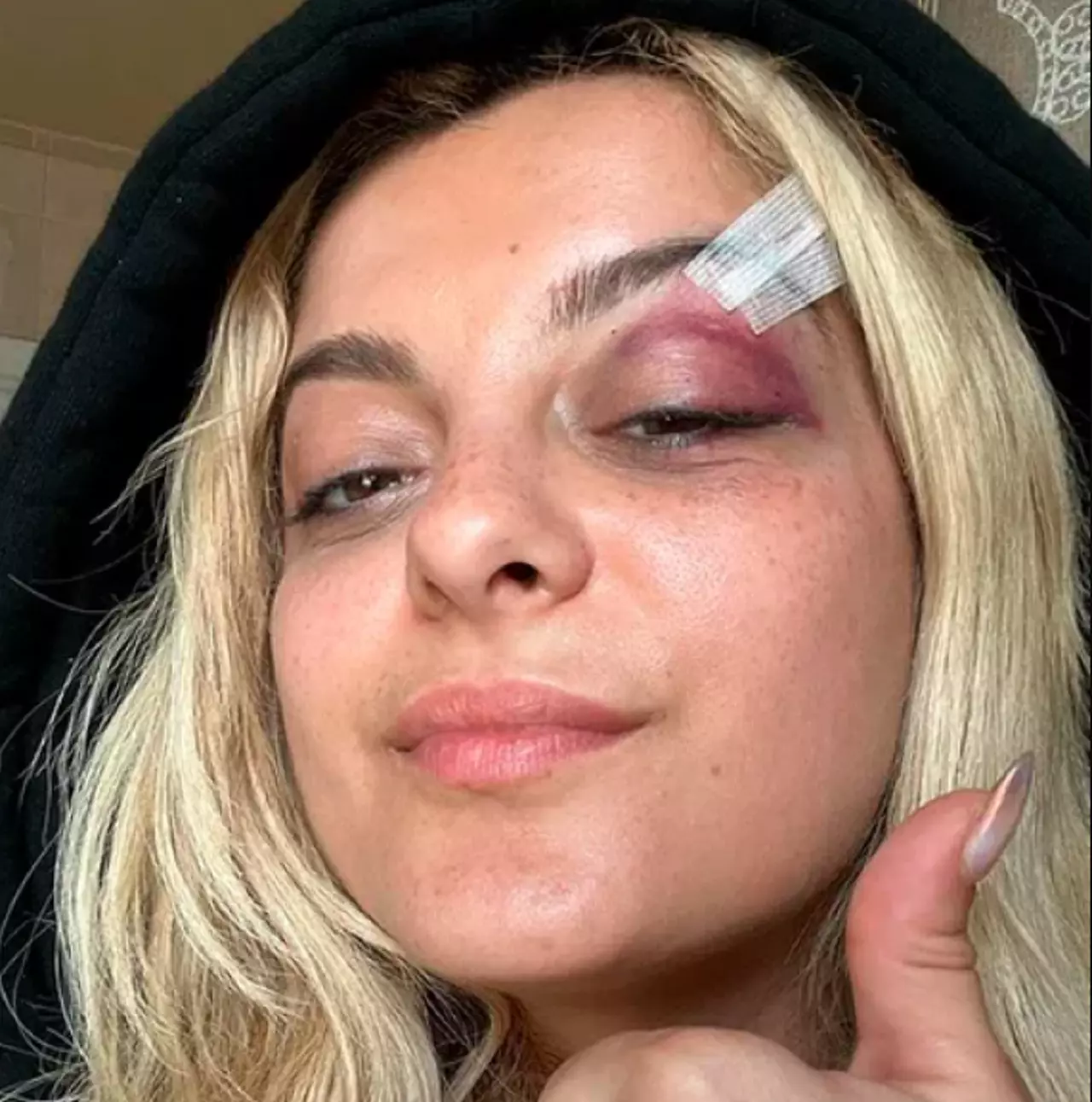 Bebe Rexha é atingida por aparelho celular durante show em NY