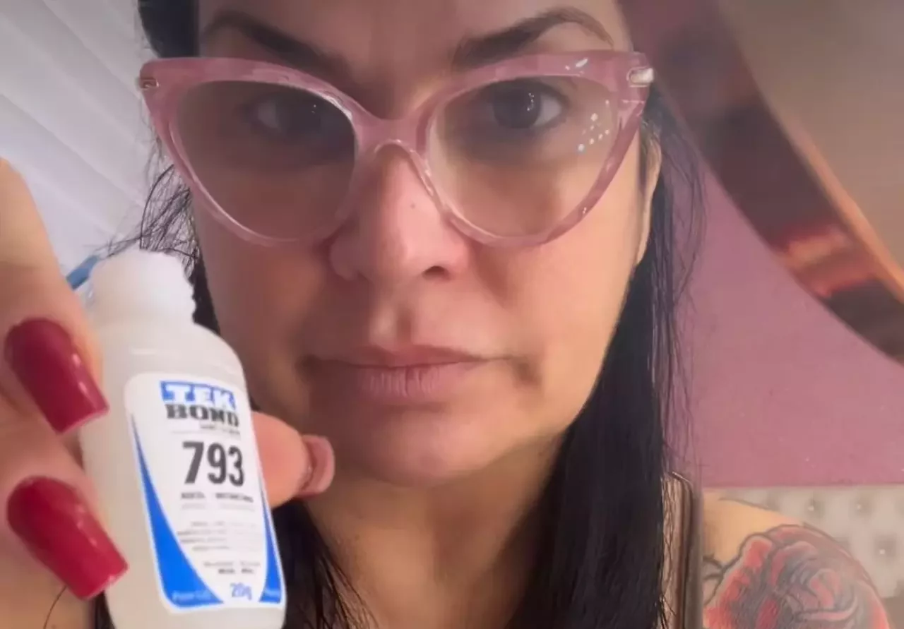 Solange Gomes cola lente de contato dental com cola; dentista explica riscos