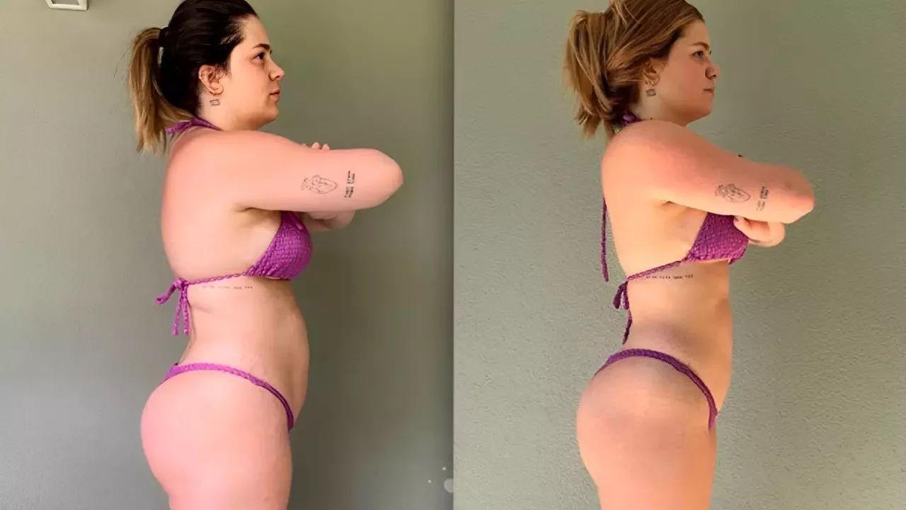 Viih Tube faz repaginada com várias plásticas, e cirurgião analisa tendência